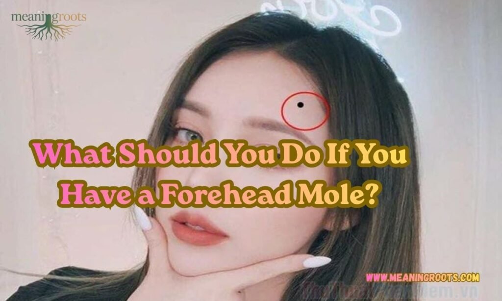 What Should You Do If You Have a Forehead Mole